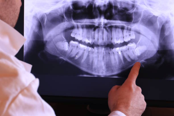 Best Urgent Care for Lost Fillings or Crowns in Basehor, KS