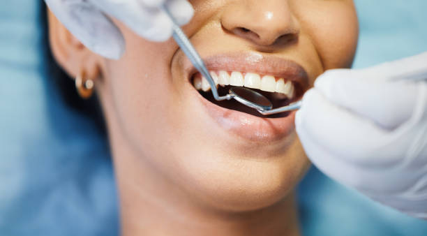 Best Emergency Gum Treatment in Basehor, KS