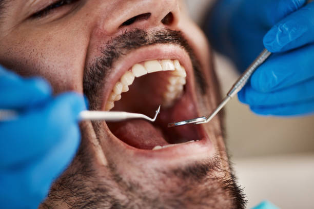 Best Emergency Treatment for Dental Infections or Abscesses in Basehor, KS