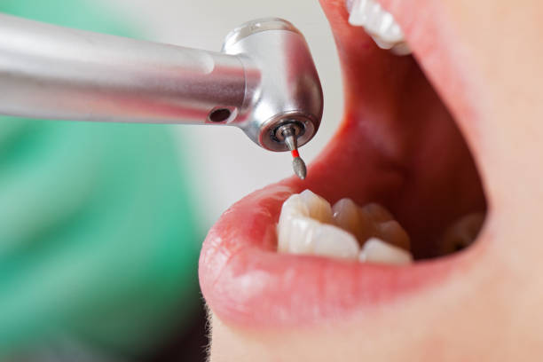 Best Cosmetic Emergency Dentistry in Basehor, KS